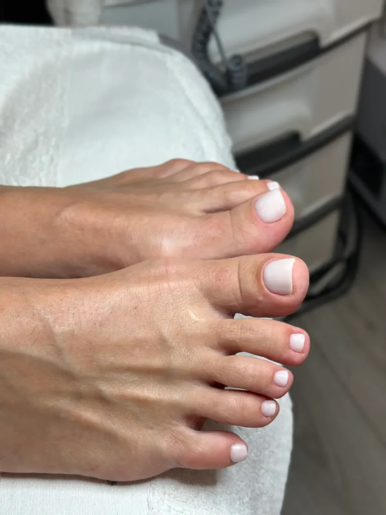 Manicure and pedicure at Sofiamed, Montenegro - Bar, Podgorica